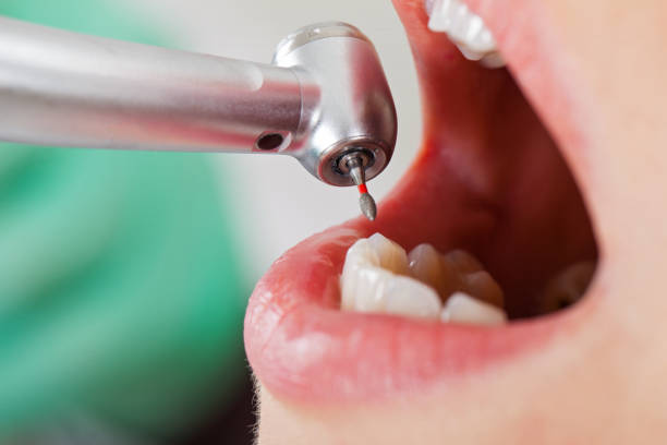 Best Emergency Pediatric Dentist  in New Rockford, ND